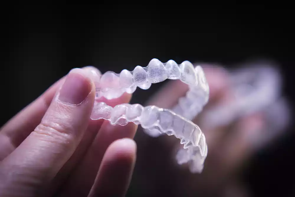 importance of retainers