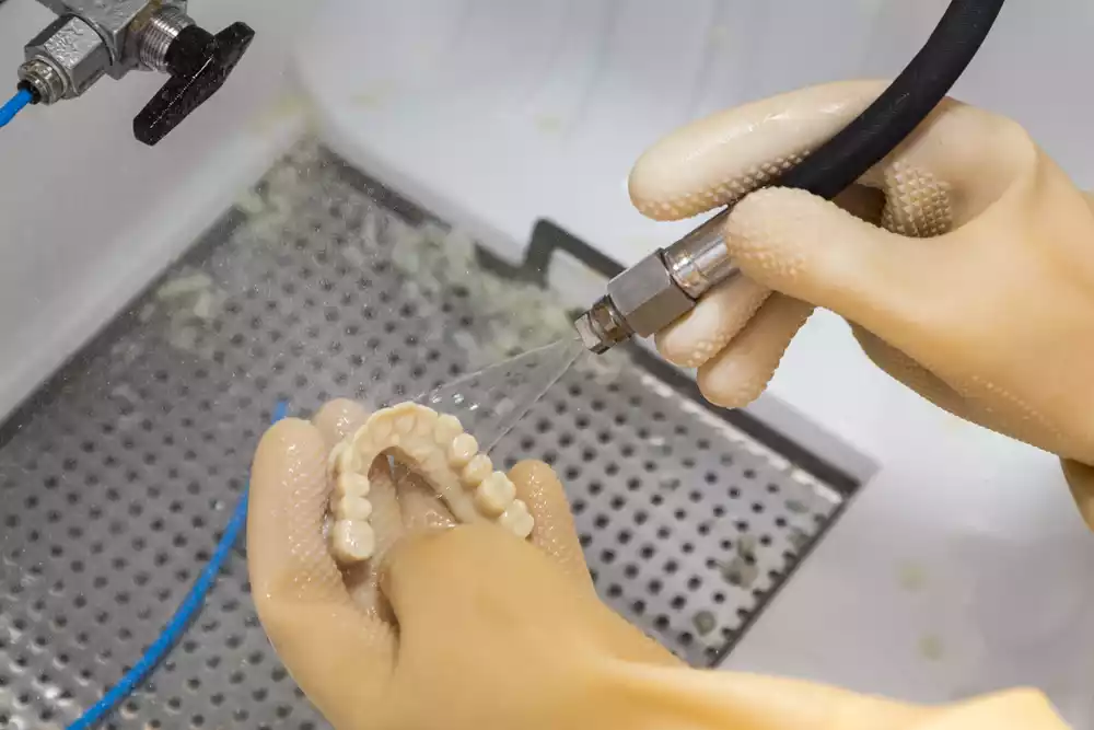 Digital smile design and 3D printing